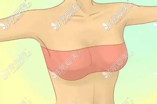 隆胸手术展示图
