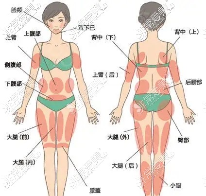 福州腰腹环吸需要多少钱?分享吸脂口碑医院吸脂价格表!