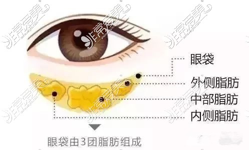 重庆哪家医院做眼袋比较好?认准这些去眼袋好的整形医院!