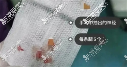 先别着急问成都小腿神经阻断术医院有哪几家?危害你知道吗!