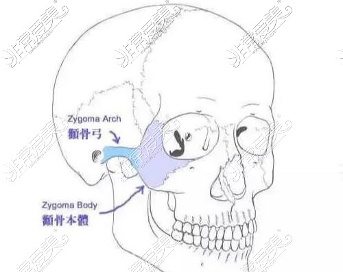 颧骨颧弓卡通图展示