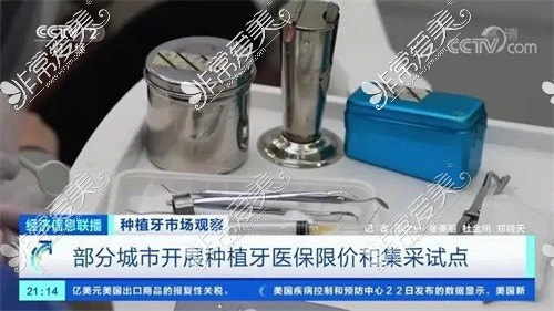 资讯:重庆种植牙集采什么时候开能纳入医保?集中采购有哪些