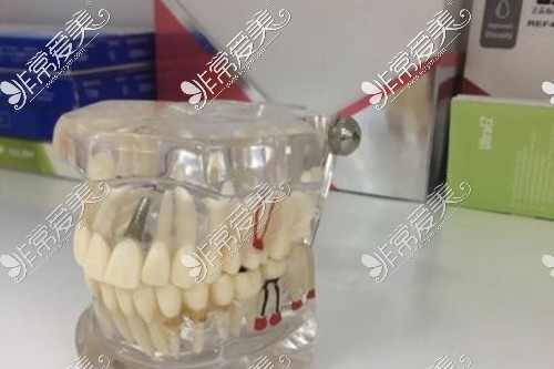 黑龙江省医疗保险看牙报销范围