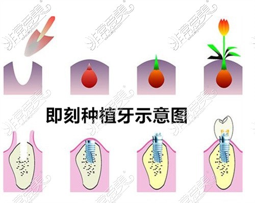 即刻负重示意图