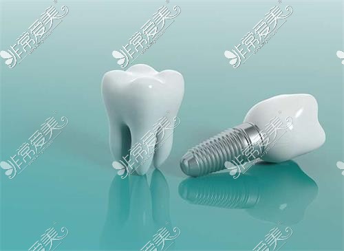 三亚种牙价格表更新，三亚正规牙科医院的种牙收费标准!