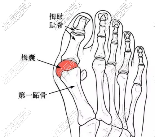 大脚骨示意图