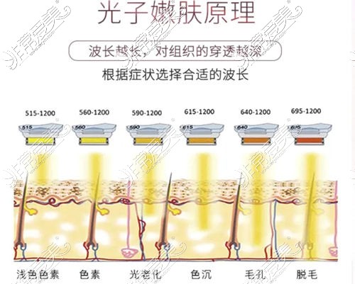 贵阳哪里做光子嫩肤好？贵阳光子嫩肤价格一览表