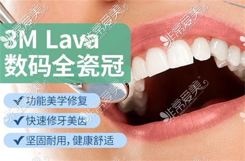 美國3M lava拉瓦全瓷牙示意圖