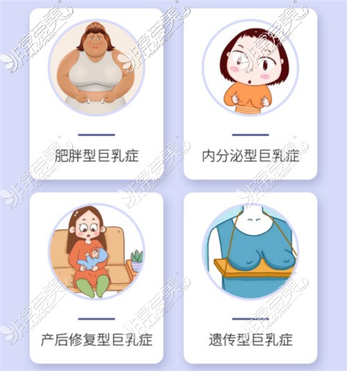 巨乳的不同形态