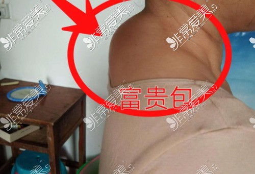 惠州美容整形医院排行，看榜单前十靠谱医院名单以及地址