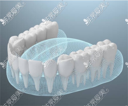 牙齿模型图
