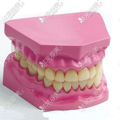 牙齿模型展示