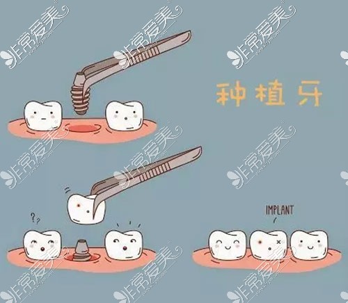 公示常州医院牙科收费价目表 2022种植牙矫正牙齿价格看这了