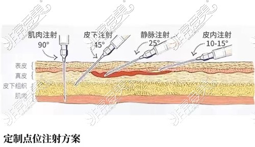 宁波雅韩整形医院定点注射