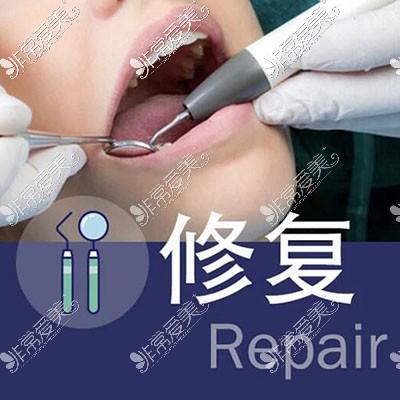 牙齿修复改善治疗展示图