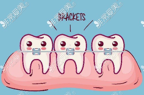 湘潭学生牙齿矫正价格是多少钱