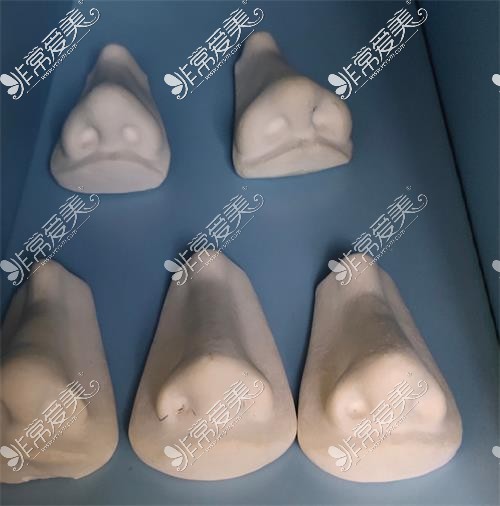 鼻整形模型示意图