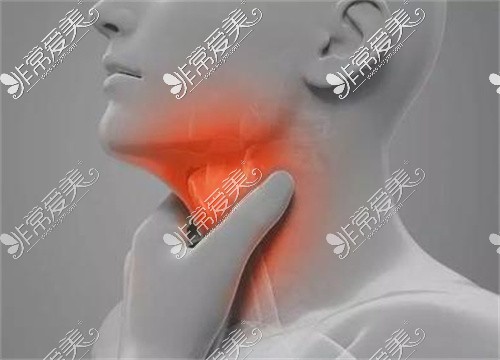 喉结医学图图片