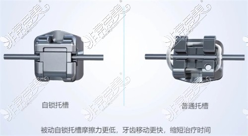 自锁矫正示意图