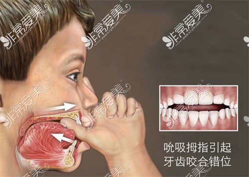 兒童常見牙科疾病