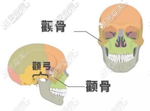 颧骨和颧弓展示图