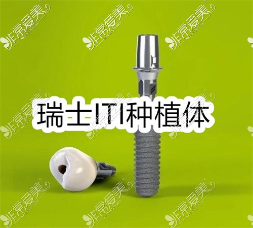 成都种植牙多少钱一颗2022价格表,含单颗半口全口种植牙价格