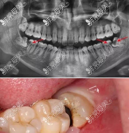 口腔牙齿ct照