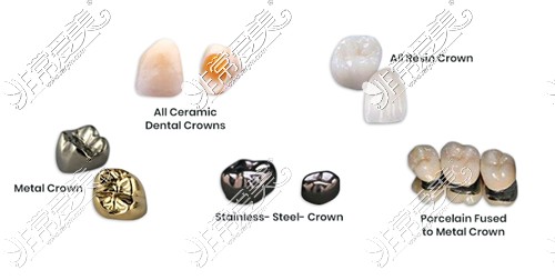 不同材质的牙冠