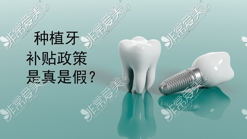 北京种植牙补贴政策是真是假
