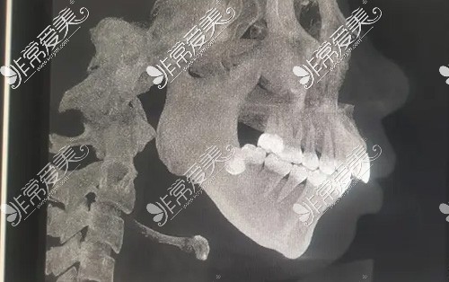 分享佛山正颌手术医院排名名单和详细地址！