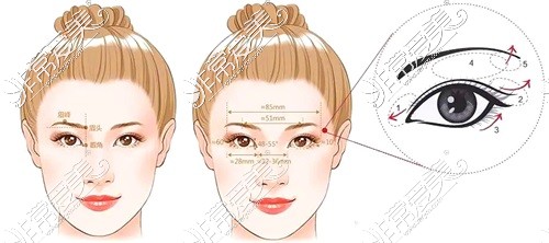 新疆整形医院双眼皮设计图