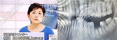 日本电视台播出了“种植牙急剧增加医疗纠纷的原因”相关报道