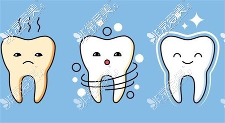 阿克苏牙科医院牙齿美白示意图
