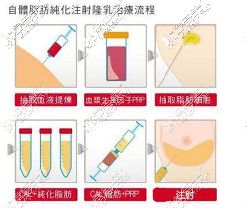 女生青春期丰胸 步骤图片