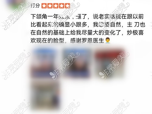 华西罗恩磨骨口碑展示