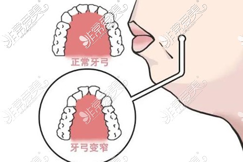 听说荔湾口腔医院收费挺贵的?详细价格表在这看完不纠结!