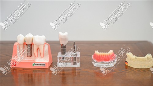 牙科模型展示图