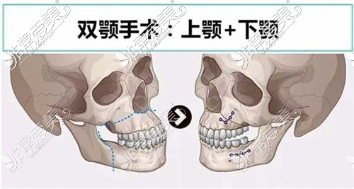 四川颌面外科医生排名前十,成都颌外名医排名前三有变化!