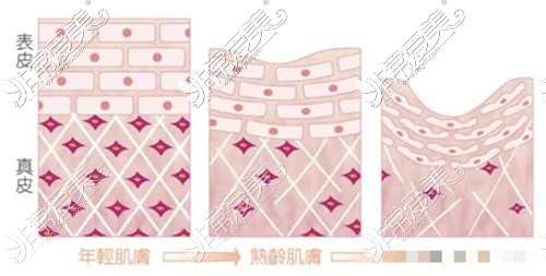 皮肤随着年龄老化示意图