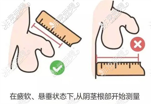 男性阴茎长度测量示意图