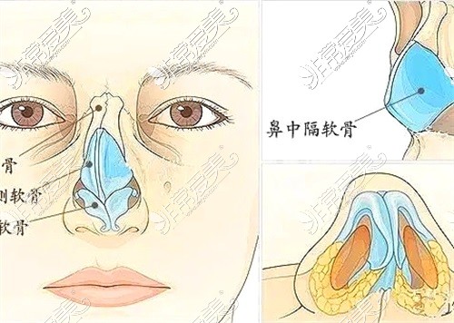 鼻中隔位置示意图