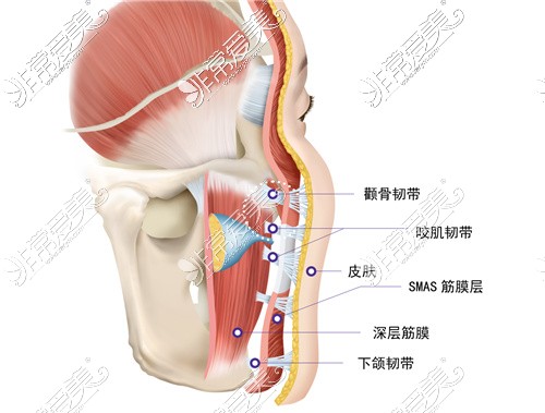 面部提升的几个常见韧带