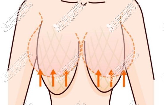 胸部下垂动画图