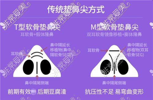 传统垫鼻尖方式示意图