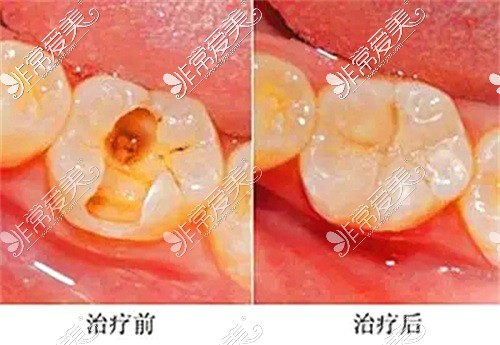 石河子齒康口腔牙齒治療圖