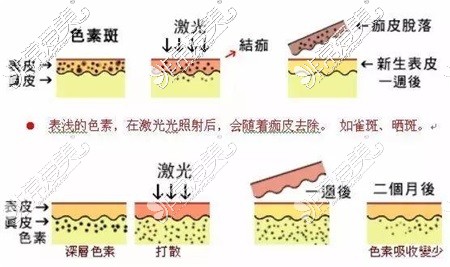 新疆哈密整形医院皮肤美容整形示意图