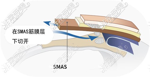 更深层的剥离层面