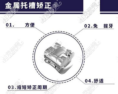 金属牙套改善图照片