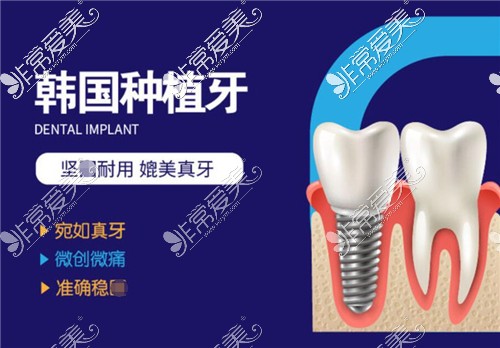 韩国种植牙示意图