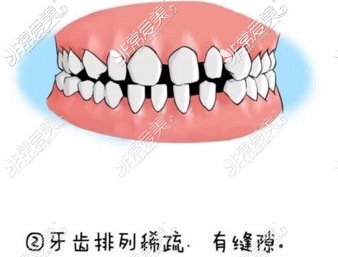 牙齿问题示意图
